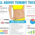 1_Evita_Liposuction_5_Tummy Tuck 3