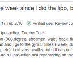 Evita_review_liposuction 3